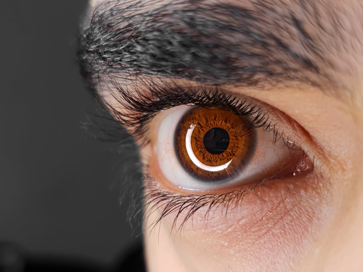 Diagram of a cornea with uneven curvature characteristic of astigmatism.