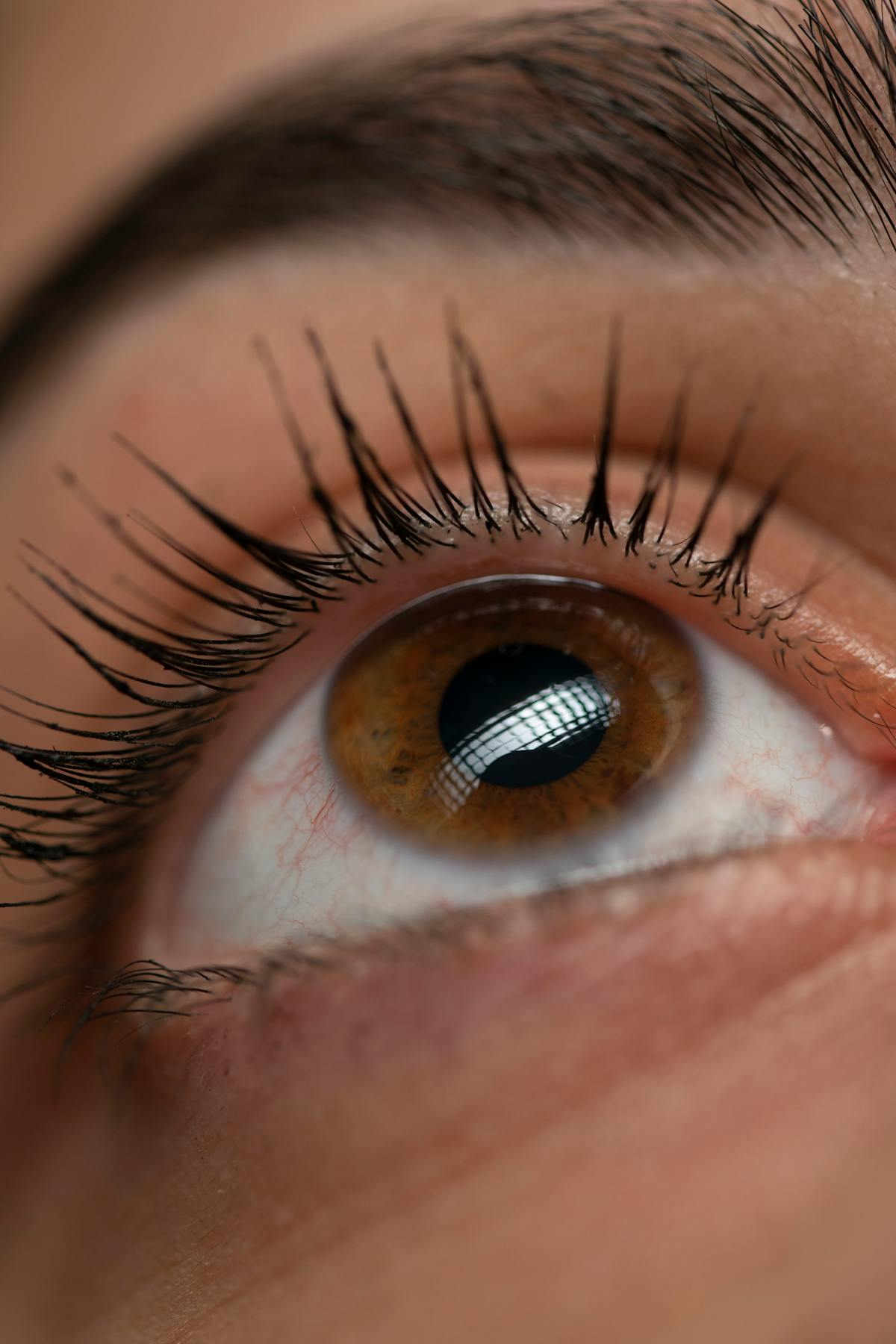 Topographic map of a cornea showing the conical shape of keratoconus.