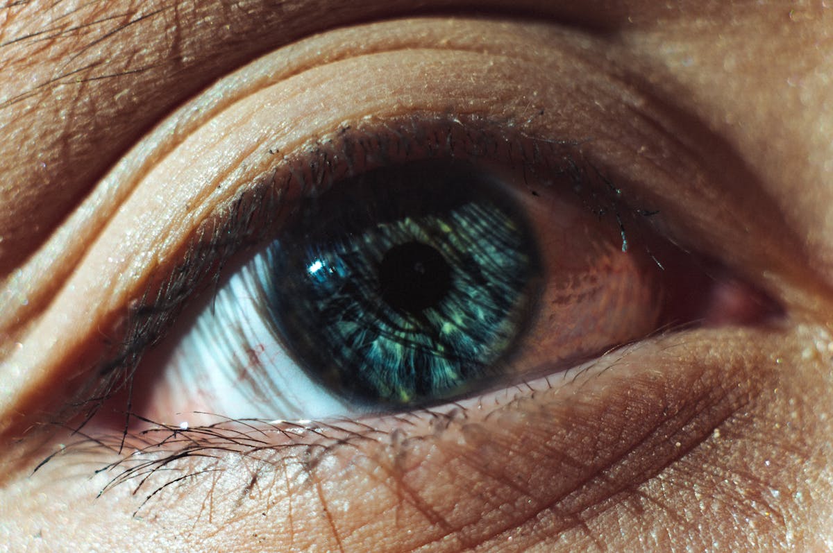 Diagram showing light focusing in front of the retina, characteristic of myopia.